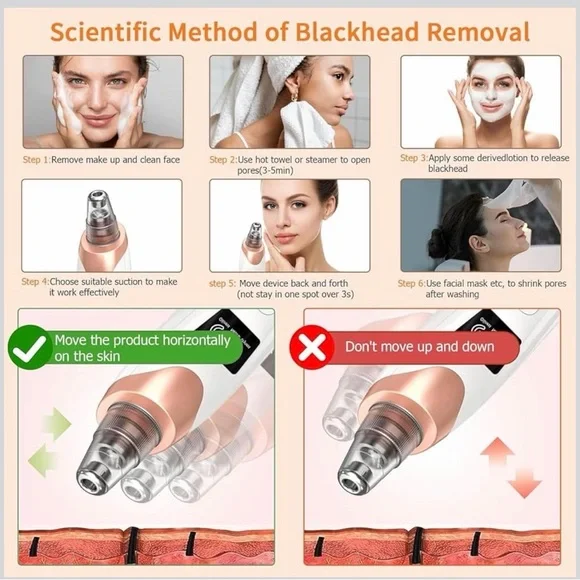 Electric Blackhead Remover Pore Vacuum - White & Rose Gold - Picture 4 of 7